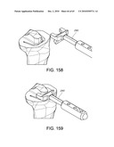 Methods and Apparatus for Performing Knee Arthroplasty diagram and image