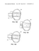 Methods and Apparatus for Performing Knee Arthroplasty diagram and image