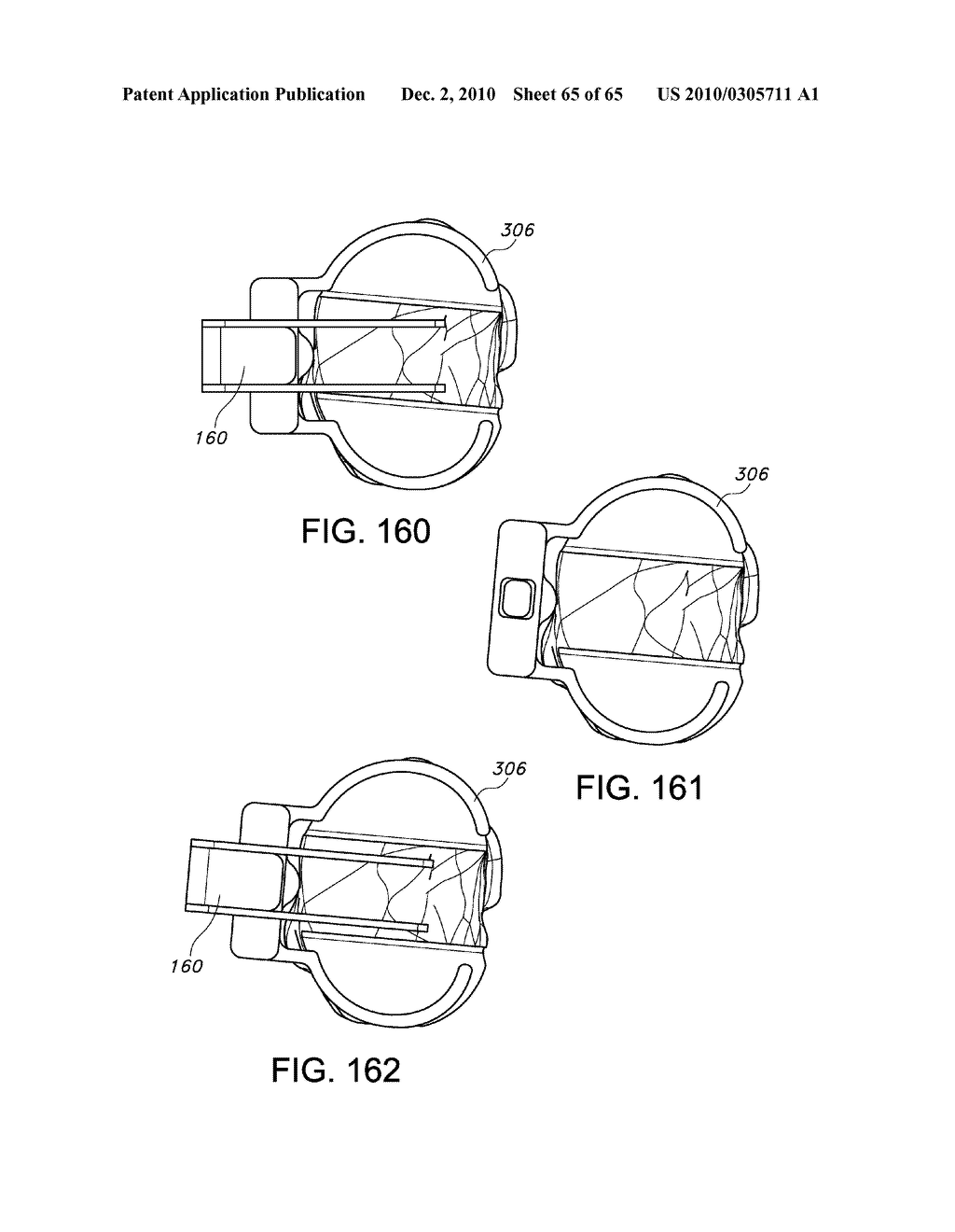 Methods and Apparatus for Performing Knee Arthroplasty - diagram, schematic, and image 66