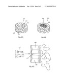 COMPRESSED POROUS MATERIALS SUITABLE FOR IMPLANT diagram and image