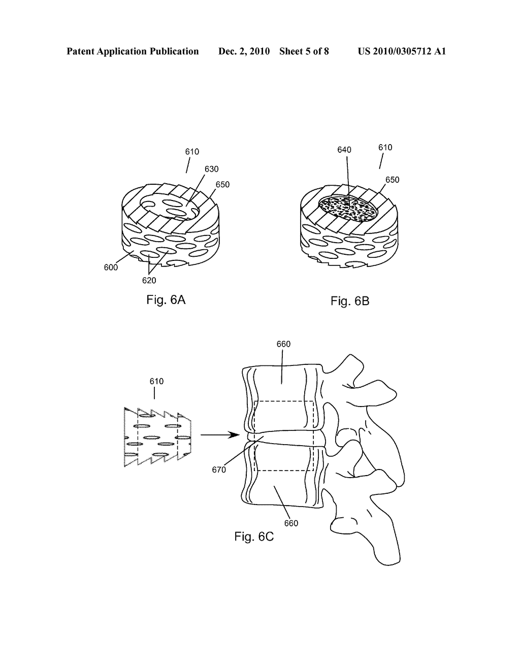 COMPRESSED POROUS MATERIALS SUITABLE FOR IMPLANT - diagram, schematic, and image 06