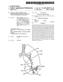 Cross-Sectional Modification During Deployment of an Elongate Lung Volume Reduction Device diagram and image