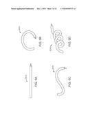 Cross-Sectional Modification During Deployment of an Elongate Lung Volume Reduction Device diagram and image