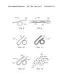 Cross-Sectional Modification During Deployment of an Elongate Lung Volume Reduction Device diagram and image