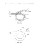 Cross-Sectional Modification During Deployment of an Elongate Lung Volume Reduction Device diagram and image