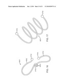 Cross-Sectional Modification During Deployment of an Elongate Lung Volume Reduction Device diagram and image