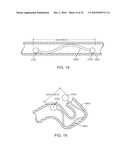 Cross-Sectional Modification During Deployment of an Elongate Lung Volume Reduction Device diagram and image