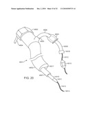 Cross-Sectional Modification During Deployment of an Elongate Lung Volume Reduction Device diagram and image