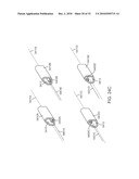 Cross-Sectional Modification During Deployment of an Elongate Lung Volume Reduction Device diagram and image