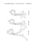 Cross-Sectional Modification During Deployment of an Elongate Lung Volume Reduction Device diagram and image