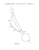 Cross-Sectional Modification During Deployment of an Elongate Lung Volume Reduction Device diagram and image