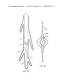 Cross-Sectional Modification During Deployment of an Elongate Lung Volume Reduction Device diagram and image