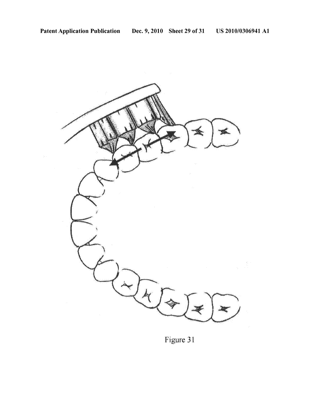 Toothbrush - diagram, schematic, and image 30