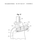 Hubless Caster Technology diagram and image