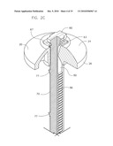 BUTTON HEAD TIE diagram and image