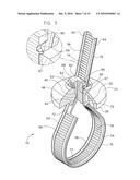 BUTTON HEAD TIE diagram and image