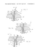 BUTTON HEAD TIE diagram and image