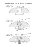 BUTTON HEAD TIE diagram and image