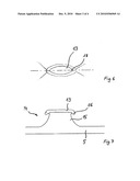 MECHANICAL FASTENER AND METHOD FOR MANUFACTURING A MECHANICAL FASTENER (AS AMENDED) diagram and image