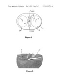 EXPRESS-REGISTERING REGIONS OF THE BODY diagram and image