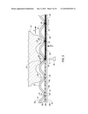 Filter Media and System and Method of Manufacturing the Same diagram and image