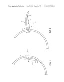 Mechanically Dampening Hold Open Road diagram and image