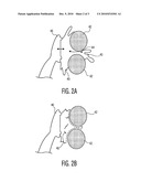 POWER TOOTHBRUSH USING A SHEAR THICKENING FLUID diagram and image