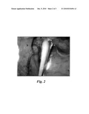 IMAGING OF MYELIN BASIC PROTEIN diagram and image