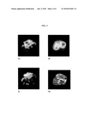 COMPOSITION AND METHOD FOR GENERATING A METABOLIC PROFILE USING 13C-MR DETECTION diagram and image