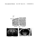 Targeting Brain Cells Via Ophthalmic Delivery diagram and image