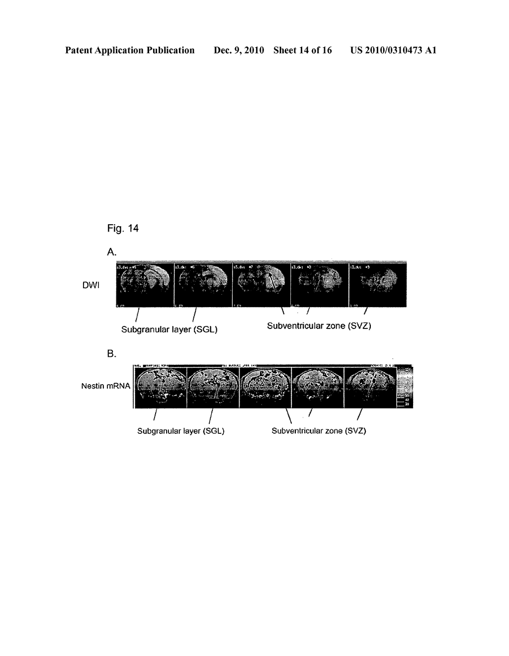 Targeting Brain Cells Via Ophthalmic Delivery - diagram, schematic, and image 15