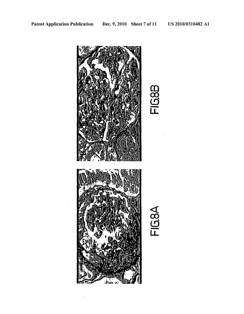 3-Deoxyglucosone And Skin - diagram, schematic, and image 08