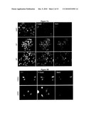 NOVEL COMPOSITIONS AND METHODS FOR CANCER TREATMENT diagram and image