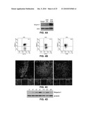 NINJURIN-1 MODULATION AND USES THEREOF diagram and image