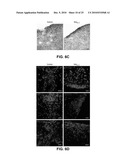 NINJURIN-1 MODULATION AND USES THEREOF diagram and image