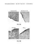 NINJURIN-1 MODULATION AND USES THEREOF diagram and image