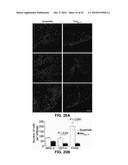 NINJURIN-1 MODULATION AND USES THEREOF diagram and image