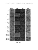 COMPOSITIONS AND METHODS FOR TREATMENT OF NEURODEGENERATIVE DISEASES diagram and image