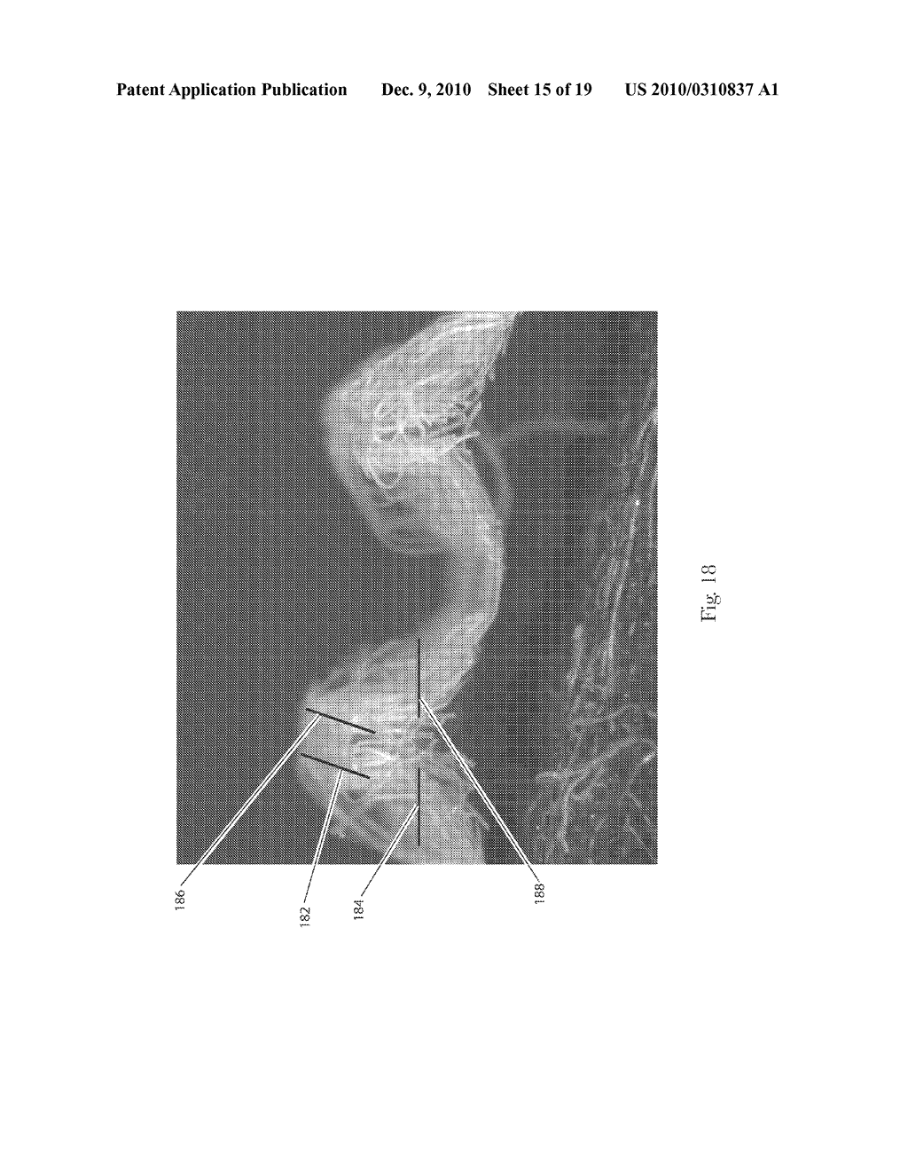 STRUCTURED FIBROUS WEB - diagram, schematic, and image 16