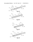 SALIVARY DUCT CONSTRICTION APPARATUS diagram and image