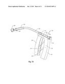 SALIVARY DUCT CONSTRICTION APPARATUS diagram and image