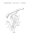 SALIVARY DUCT CONSTRICTION APPARATUS diagram and image