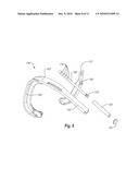 SALIVARY DUCT CONSTRICTION APPARATUS diagram and image