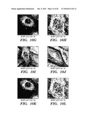 METHODS OF DELIVERY OF EXOGENOUS PROTEINS TO THE CYTOSOL AND USES THEREOF diagram and image