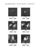 METHODS OF DELIVERY OF EXOGENOUS PROTEINS TO THE CYTOSOL AND USES THEREOF diagram and image