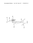 APPARATUS FOR IMPROVING A GOLF SWING diagram and image