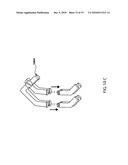 APPARATUS FOR IMPROVING A GOLF SWING diagram and image