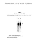 ANTIANDROGEN OLIGONUCLEOTIDES USABLE FOR THE TREATMENT OF DERMATOLOGICAL ANDROGEN-RELATED DISORDERS RELATING TO ANDROGEN METABOLISM, THEIR PHARMACEUTICAL COMPOSITIONS, THEIR USES AND TREATMENT METHOD diagram and image