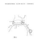 ASSEMBLY AND METHOD FOR AUTOMATICALLY CONTROLLING PRESSURE FOR A GASTRIC BAND diagram and image