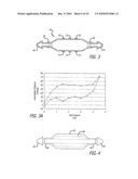 ASSEMBLY AND METHOD FOR AUTOMATICALLY CONTROLLING PRESSURE FOR A GASTRIC BAND diagram and image